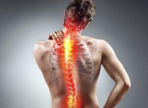 Sciatica