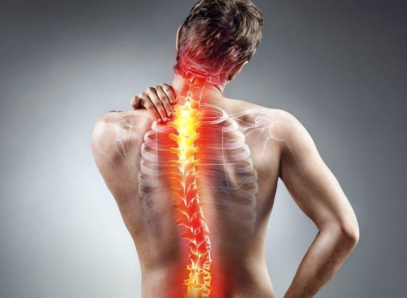 Sciatica
