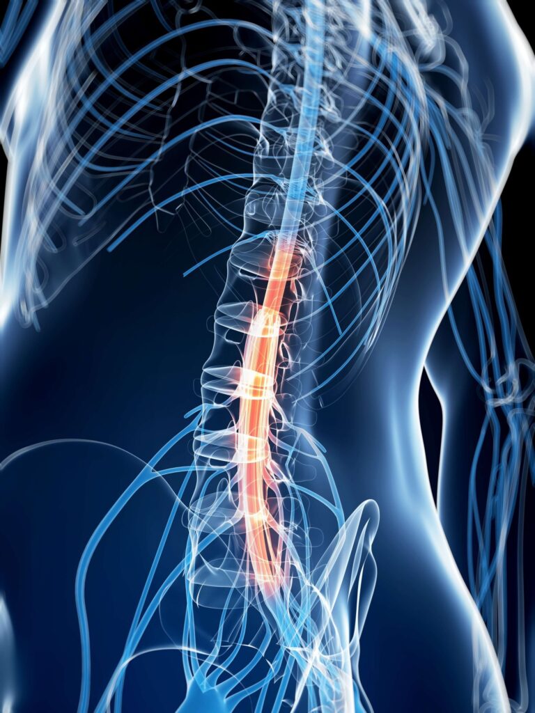 Dorsal Root Ganglion