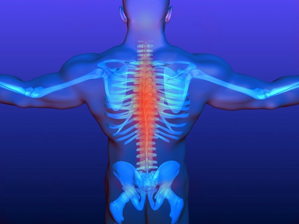 Dorsal Root Ganglion Stimulation