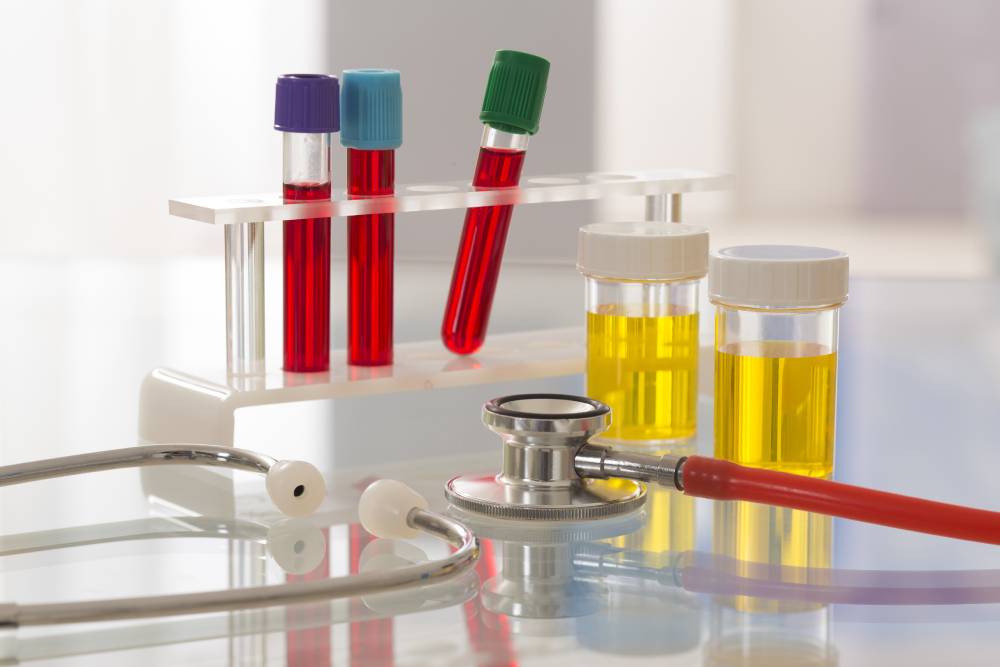 Blood Test