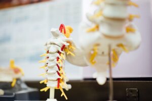 Aurora ZIP® Implant