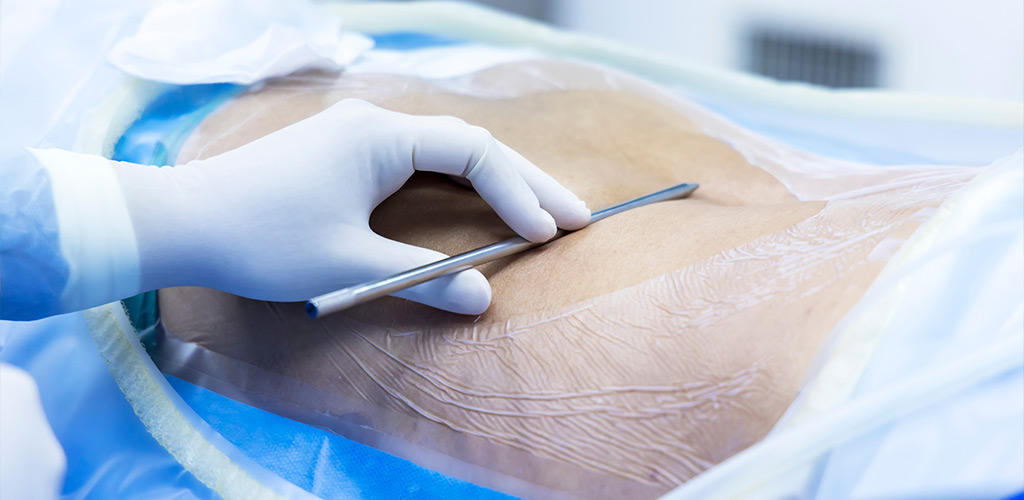 Minimally Invasive Spine Treatments