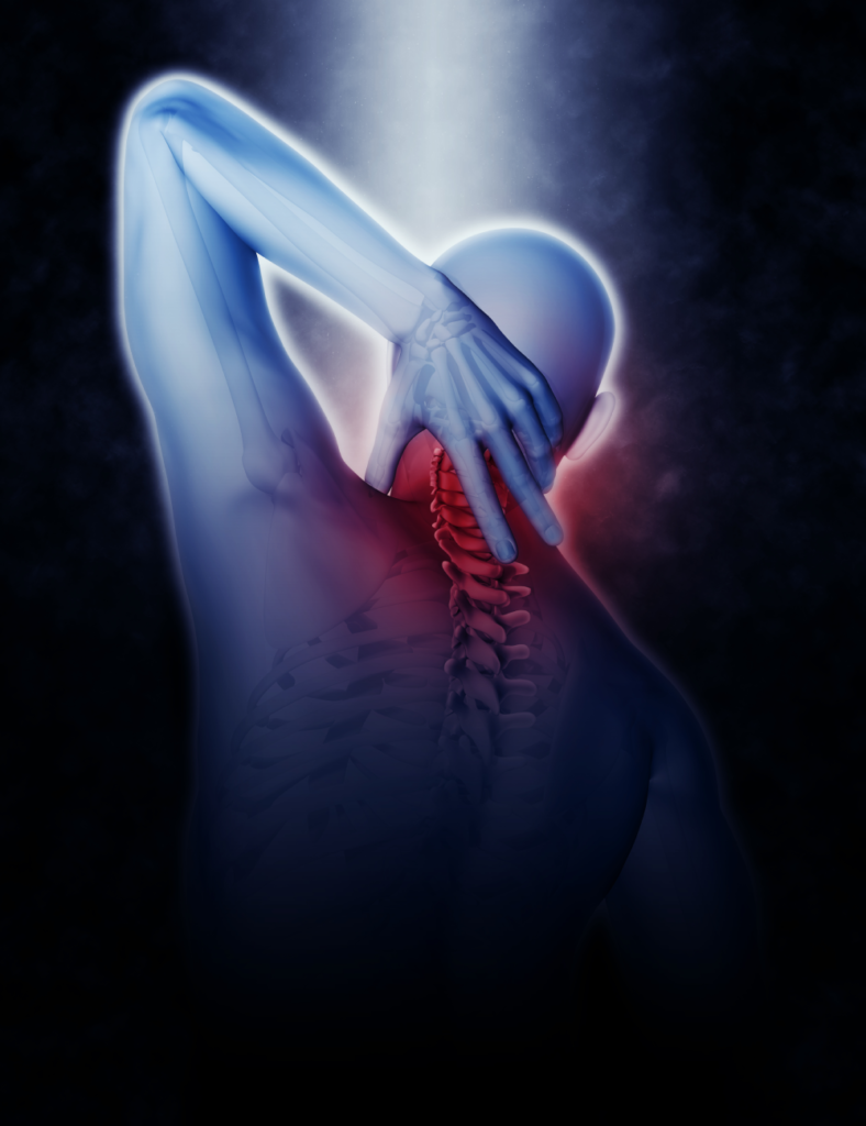 Neuropathic Pain